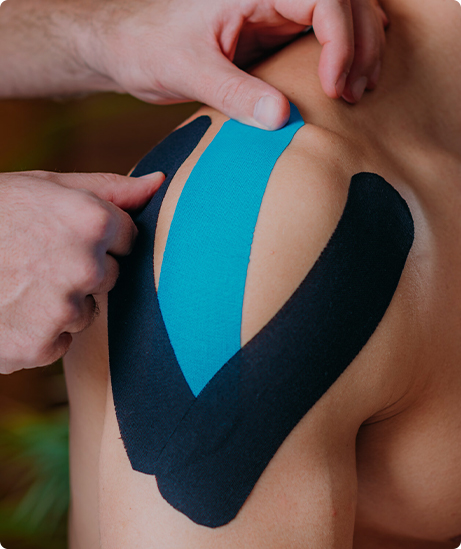 การป้องกันกีฬา